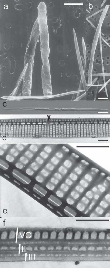 Key Hybrid Stages Observed In Sexual Reproduction Between