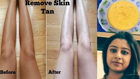 How To Remove Sun Tan From Your Body Tan Removal Pack 100
