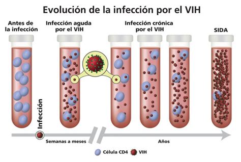 prueba carga viral de vih sida interpretacion de resultados precio