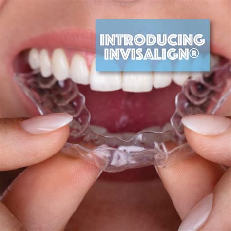 straighter teeth  braces  straighter teeth  metal  wire