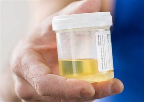 radboudumc zet urinethuistest  bij controle op terugkerende blaaskanker doq