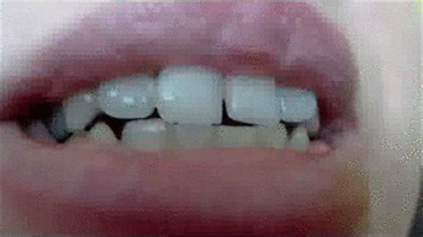 Aliceinwonderland Throat Teeth Tonsils Piercings Wmv