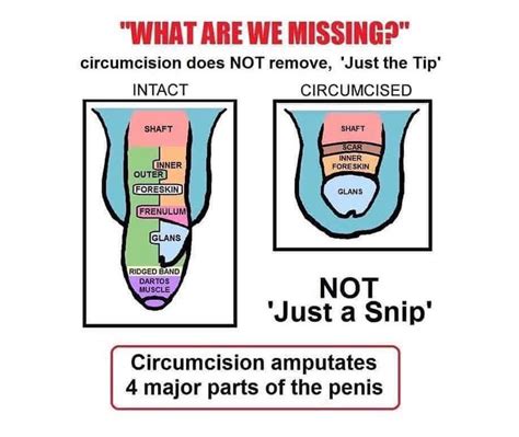 male circumcision the unkindest cut freshmag
