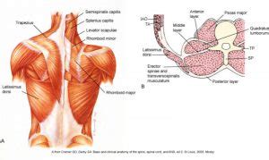 lumbodorsal thoracolumbar fascia   source    pain