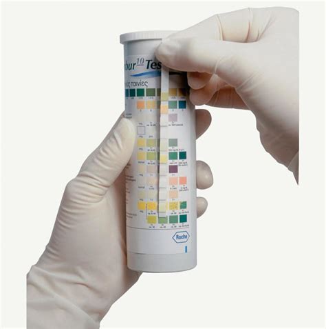 great  combur urine test strips  tests urine testing  roche