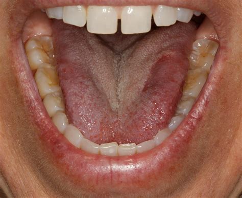 teeth mouth open centreville dental wellness center