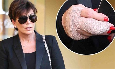 kris jenner shows bandaged hand after getting surgery daily mail online