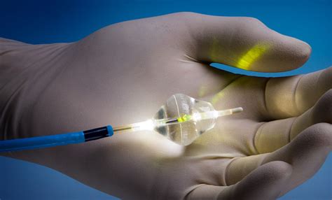How Lasers Are Helping Treat Urological Conditions