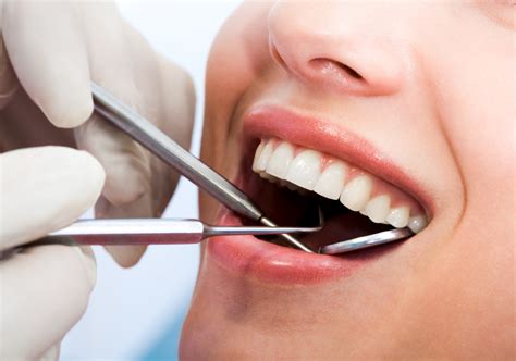 smile     cost dental services  community colleges