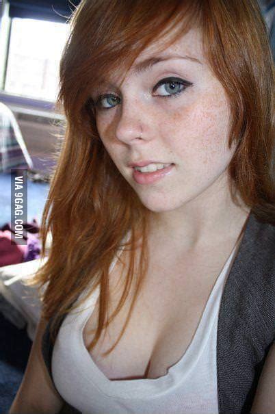 Does Anyone Else Think Freckles Are Sexy 9gag