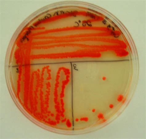 Staphylococcus Roseus Microbewiki