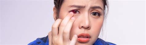 Corneal Abrasions Causes Symptoms Diagnosis And Treatments