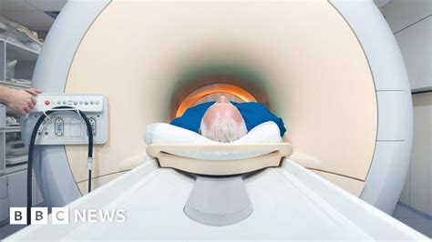 Viewpoint Prostate Cancer Screening Test In Sight