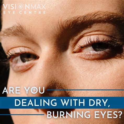 Dealing With Dry Burning Eyes Artofit