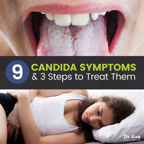 9 Candida Symptoms And 3 Steps To Treat Them Dr Axe