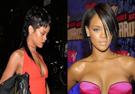 Better Or Worse 10 Black Celebs Caught Under The Knife