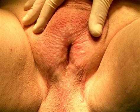 urethral reroute chastity mega porn pics