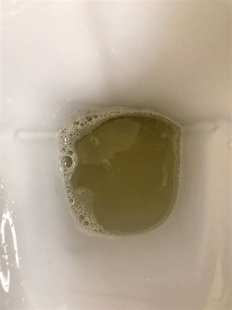 foam  urine   protein