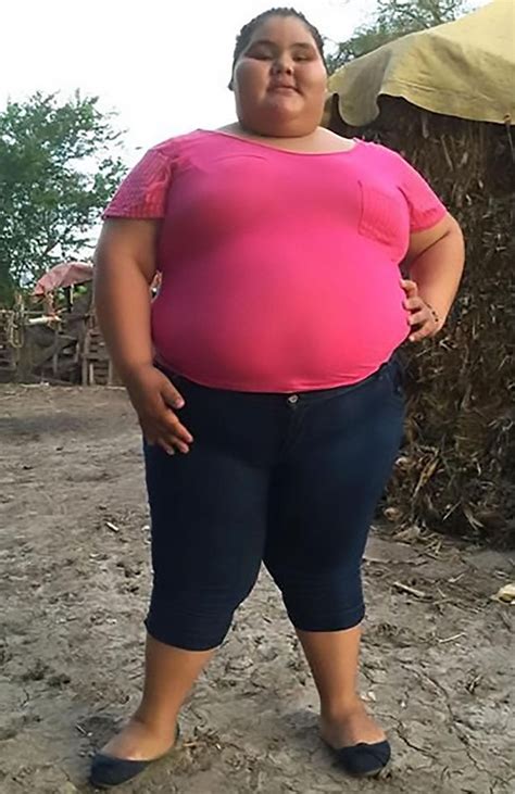 Fattest Teenager In World Sheds 14st – See Her Amazing Free Download