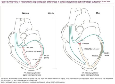 explaining sex differences in cardiac resynchronisation