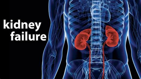 kidney failure  symptoms diet treatment