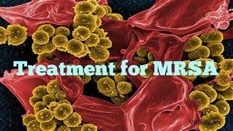 treatment for mrsa infection at home