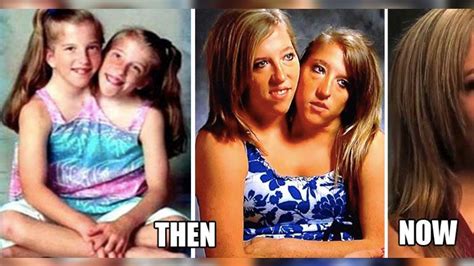see what conjoined twins abby and brittany hensel look like today