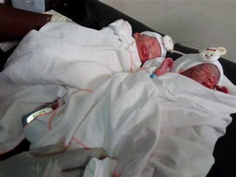 A 53 Year Old Woman Delivers Twins Through Ivf Classic Ghana