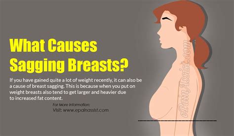 what causes sagging breasts