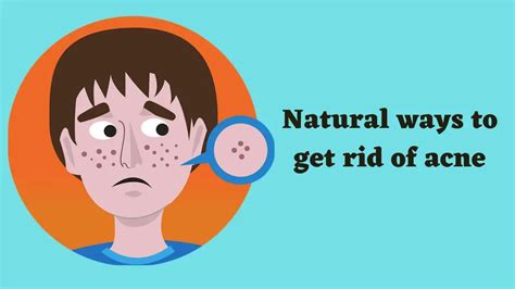 natural ways   rid  acne psyspeaks
