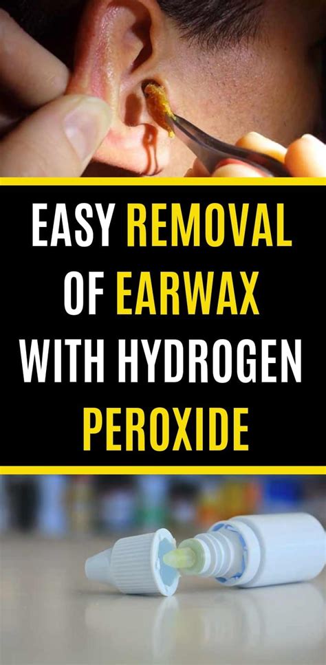 easy removal  earwax  hydrogen peroxide ear wax clean ear wax