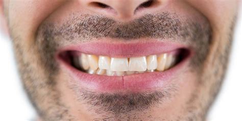 swiss dental spa mondhygienistenpraktijk  de bilt