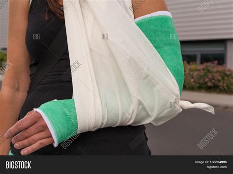 woman broken arm image photo  trial bigstock