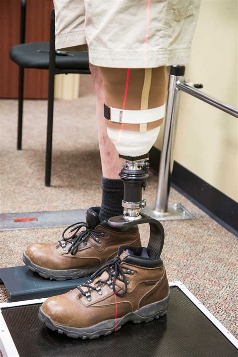 foolproof steps   proper prosthetic limb fitting premier prosthetic