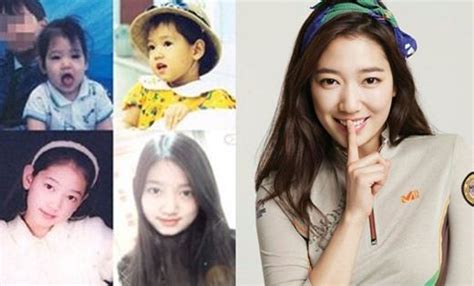 park shin hye plastic surgery before and after photos