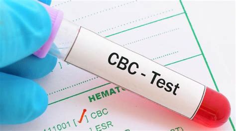 complete blood count test cbc blood test  delhi ncr ayushkama healthcare