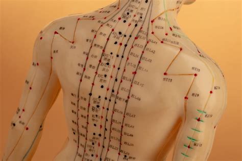acupuncture benefits northern medical center middletown ny