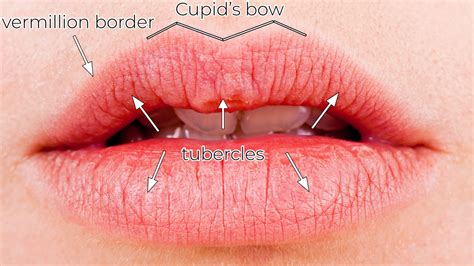 avoid lip filler migration botched lips  tips