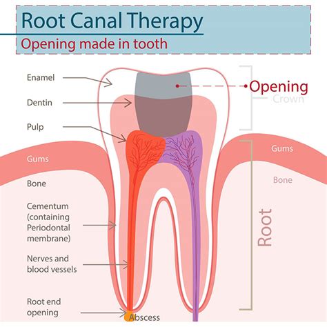 root canals  sterling  kimberly  suter dds pc