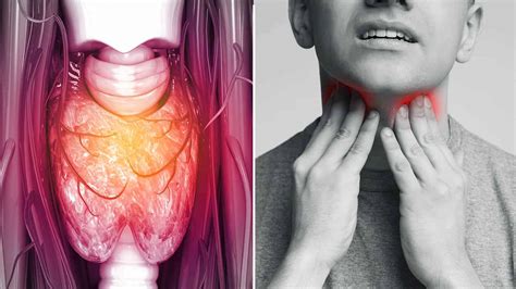 10 Signs Of Throat Cancer To Never Ignore 5 Minute Read