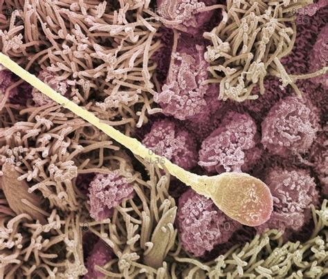 magnification view of a sperm cell under a color scanning electron