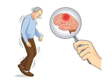 parkinsons disease brain symptoms