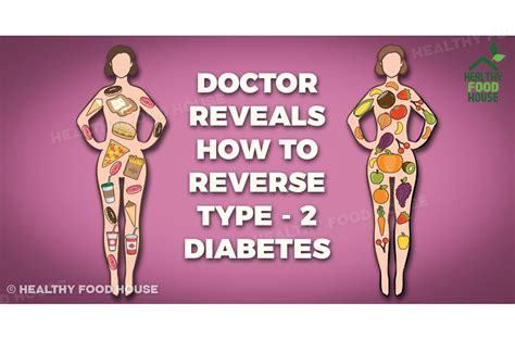steps  reverse type  diabetes