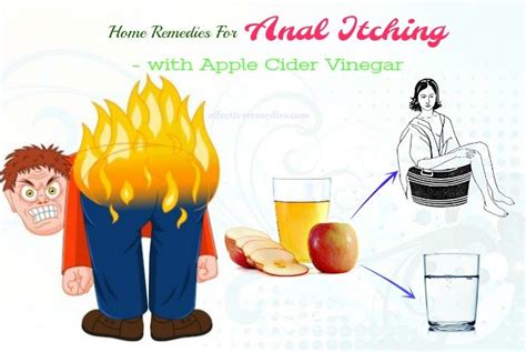8 best home remedies for anal itching 100 natural and safe