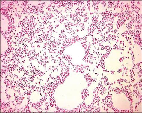 Laboratory Perspective Of Gram Staining And Its