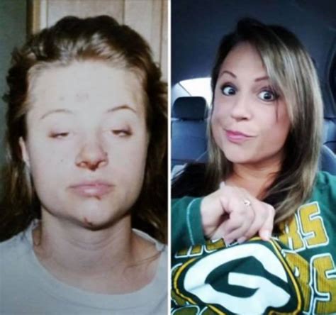 inspiring photos show drug users before and after they got clean