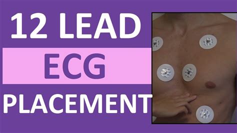 lead ecg electrode placement