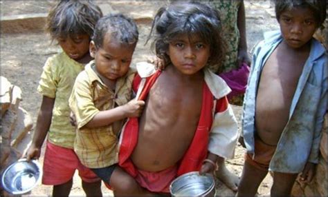 india shamed  child malnutrition  pm singh bbc news