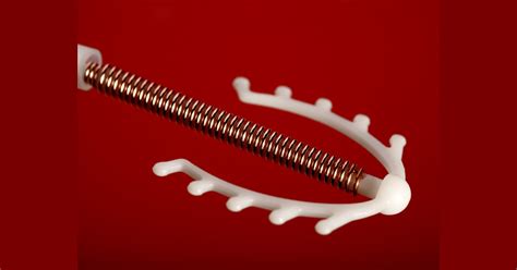 iuds implants best for birth control even for teens docs say