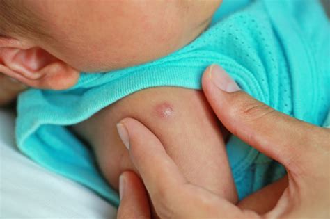 takut bayi demam setelah imunisasi bisa diatasi  tips